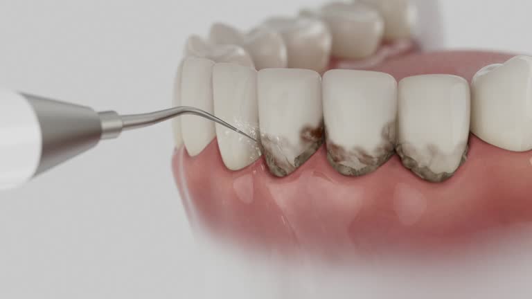 Reliable Wisdom Tooth Removal contractor in Hall County County, GA by Dentist Open Now